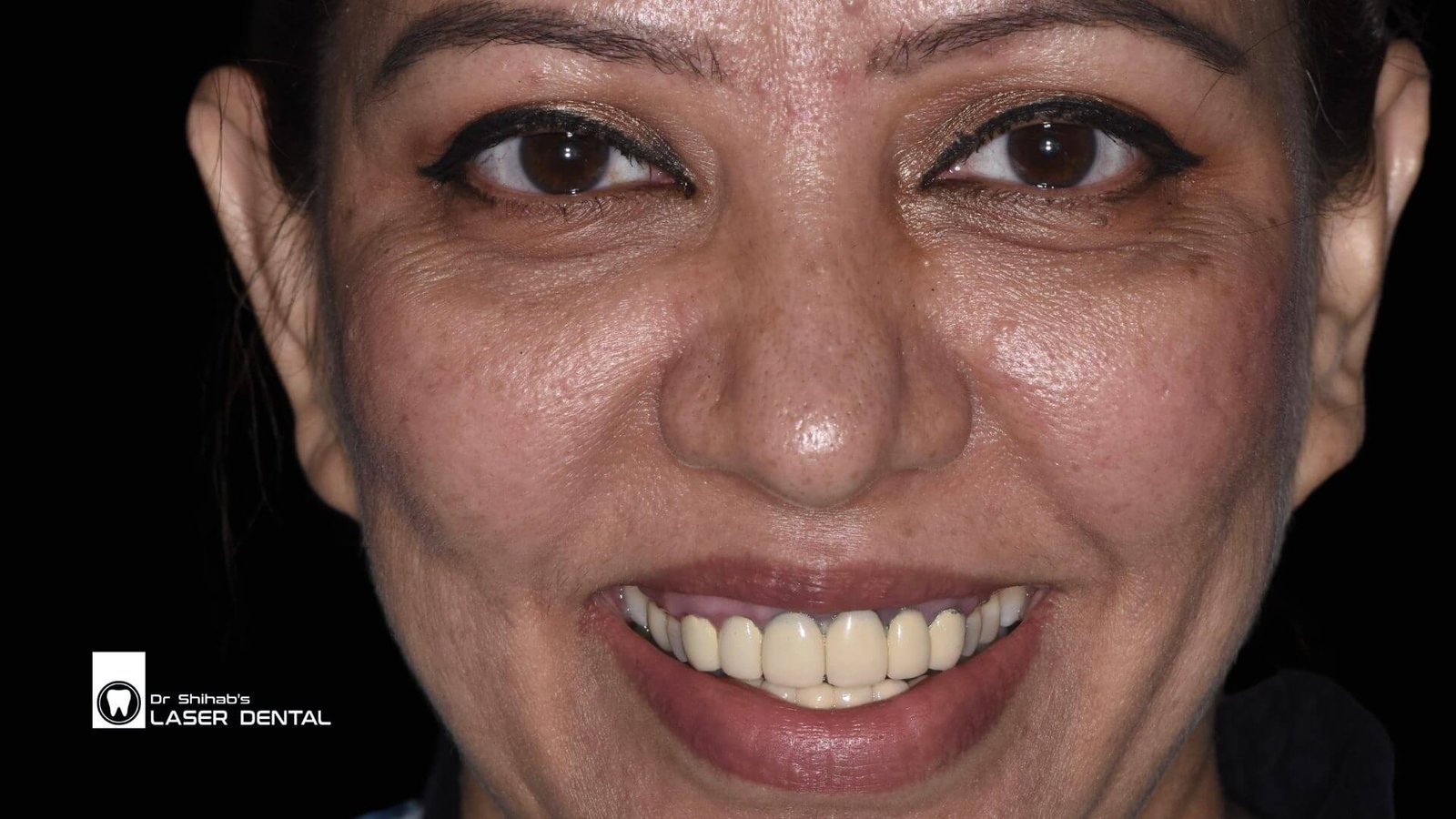 Laser Dental