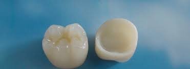 Zirconia Crown