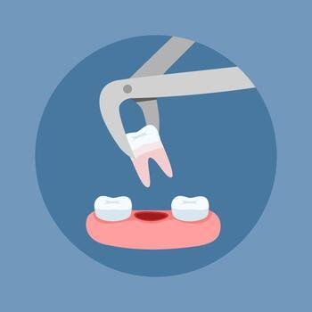 Minor Oral Surgery