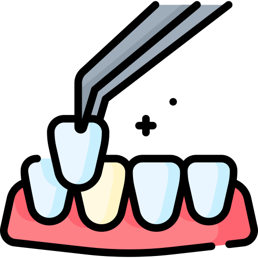 Veneers