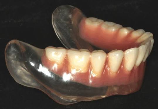 Complete Denture (single jaw)